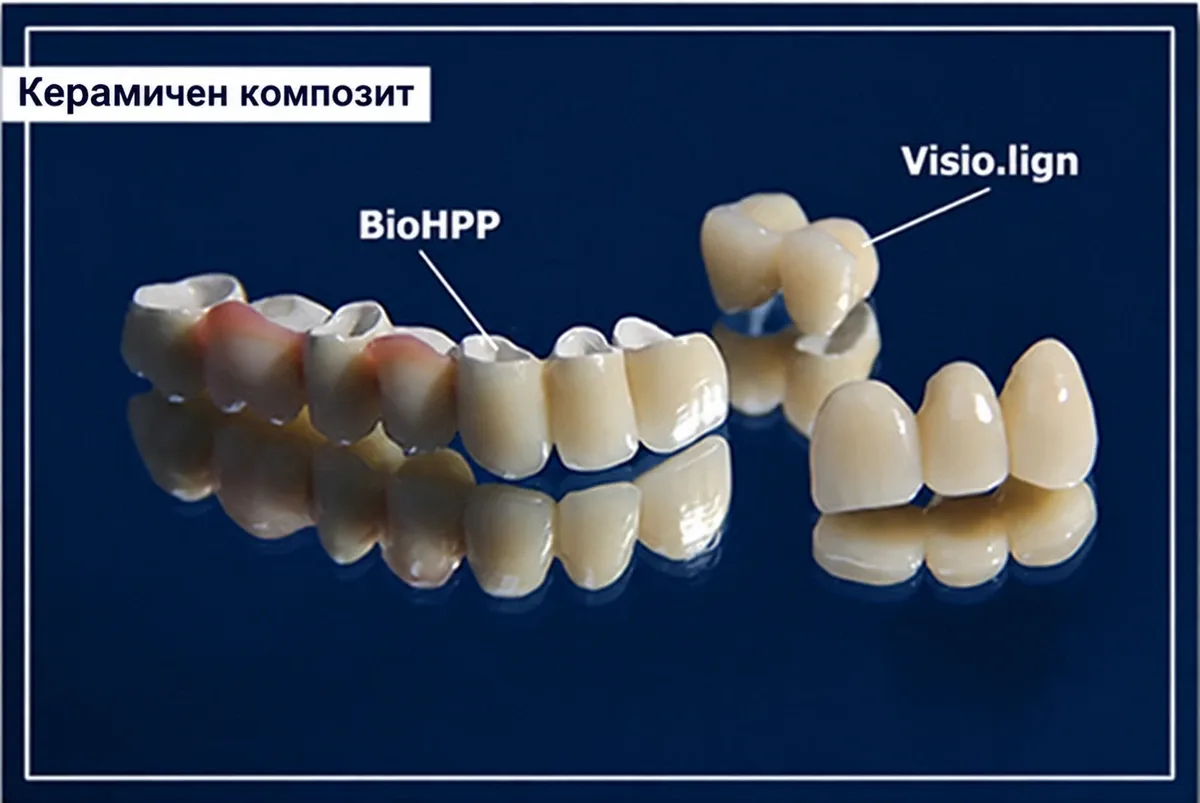 Керамичен композит: BioHPP и Visio.lign